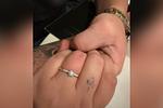 Αρραβώνας με…επείγον: Δαχτυλίδι παραλίγο να της κοστίσει το δάχτυλο!