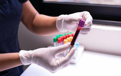 Επανάσταση στην Ιατρική: Νέος Άτλας Αίματος Προβλέπει Δεκάδες Ασθένειες!