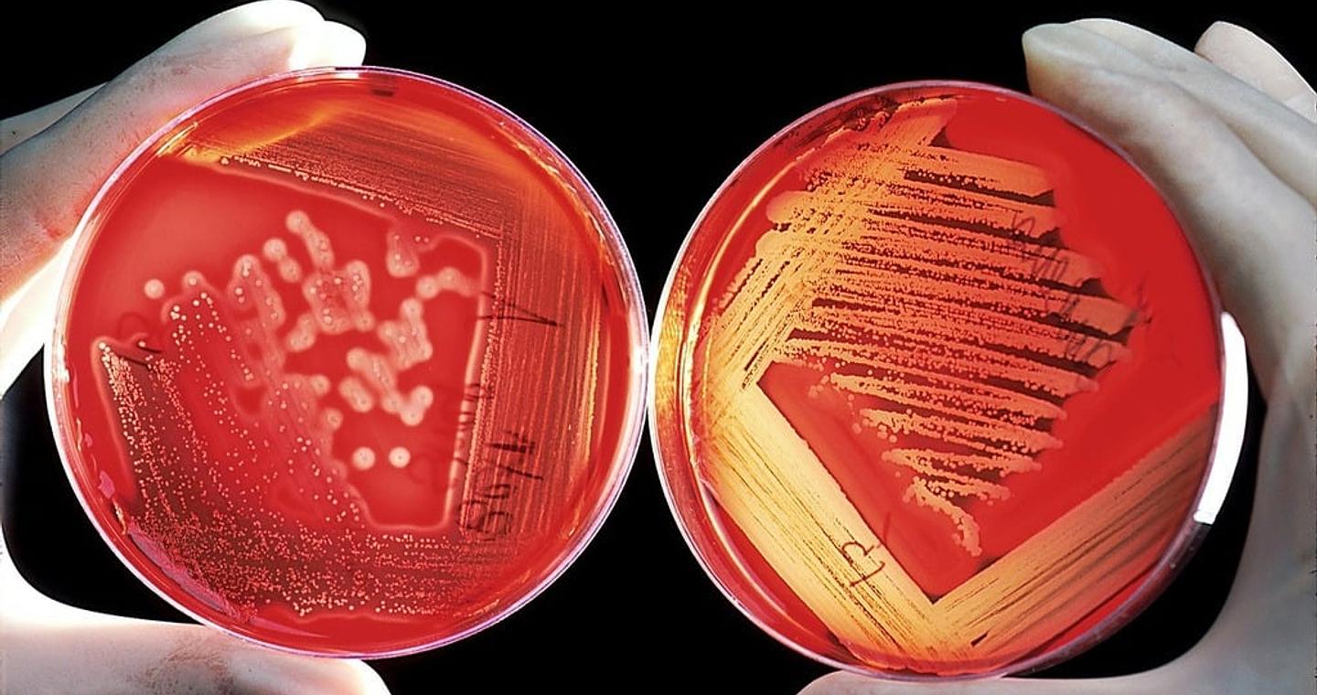 «Κρυμμένο» αντιβιοτικό 100 φορές ισχυρότερο ενάντια στα υπερβακτήρια