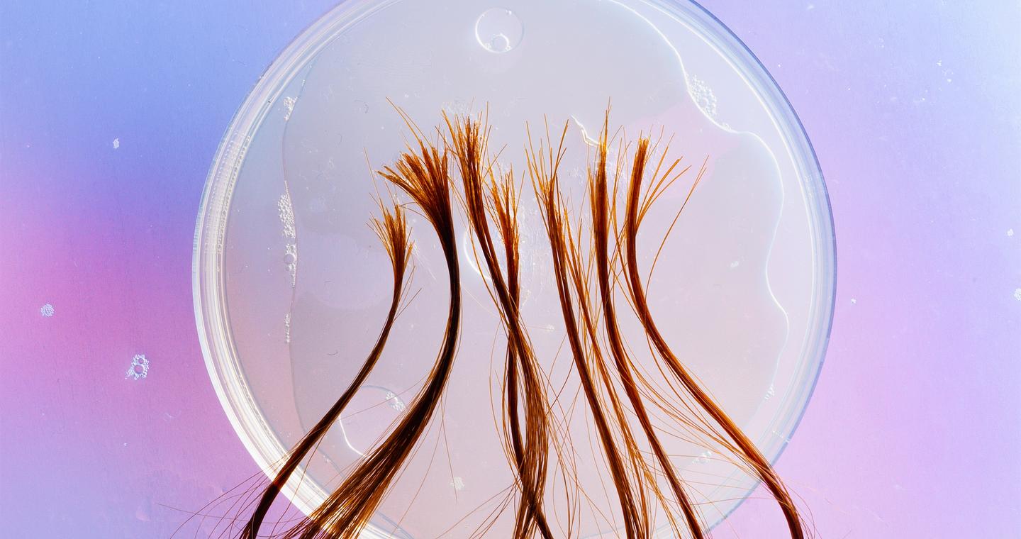 Πώς οι τρίχες «μιλούν» για την υγεία μας