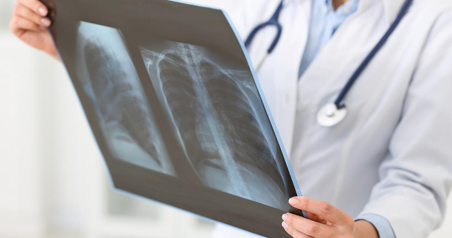 Η πρώτη αιτία θανάτου από μολυσματική νόσο  που σκότωσε 1,23 εκατ. ανθρώπους το 2024