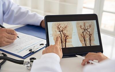 Εγκεφαλικό VS Ανεύρυσμα: Τι πρέπει να γνωρίζετε για να προστατευτείτε!