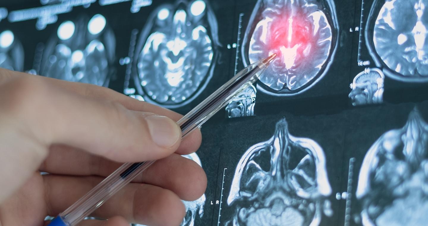 Ερευνα: Η εφηβεία διαρκεί μέχρι τα 30