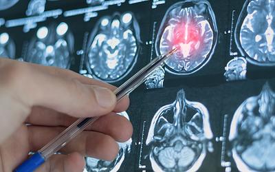 Ο εγκέφαλος αλλάζει: Οι 5 φάσεις της ζωής και οι ηλικίες-κλειδιά