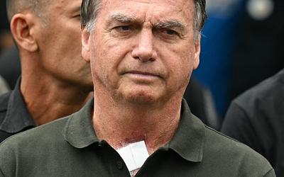 Βραζιλία: Άδεια στον Μπολσονάρου για χειρουργείο τα Χριστούγεννα – Όλες οι λεπτομέρειες