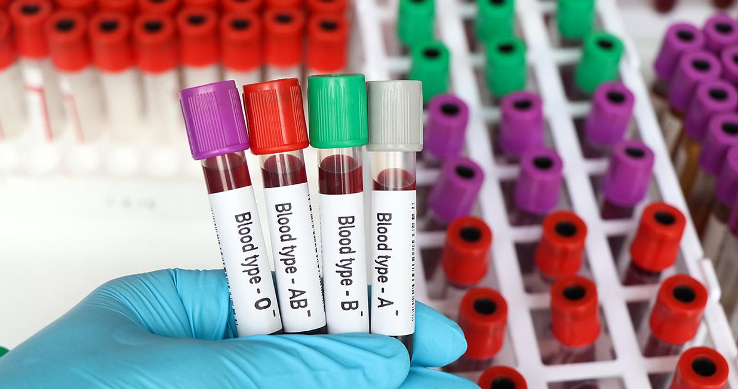 Τα πλεονεκτήματα και τα μειονεκτήματα των ομάδων αίματος Α, Β, ΑΒ, Ο – Ποιος διατρέχει μεγαλύτερο κίνδυνο για καρκίνο, νοροϊό και τσιμπήματα εντόμων