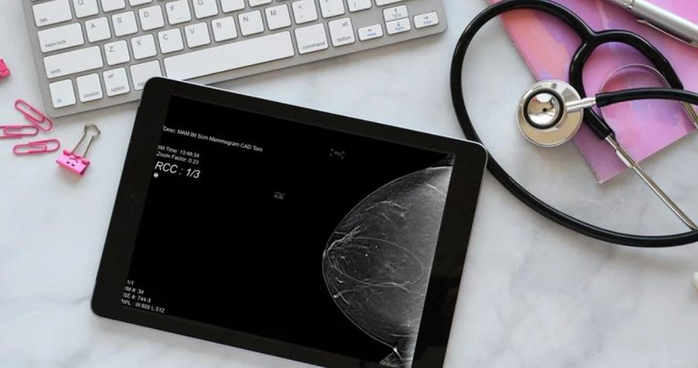 Καρκίνος του μαστού: Νέα δεδομένα αλλάζουν τον τρόπο πρόληψης της νόσου