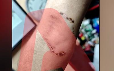 Ομόνοια: 21χρονος εξαπέλυσε το pitbull σε 30χρονο για ληστεία!