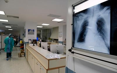 Έξαρση γρίπης: Πάνω από 870 εισαγωγές και αυξανόμενη ανησυχία