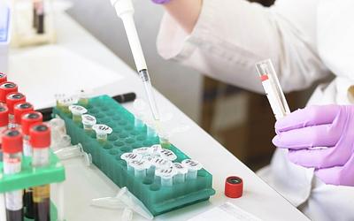 Ιός Νίπα: Συναγερμός στην Ασία – Τι πρέπει να γνωρίζετε