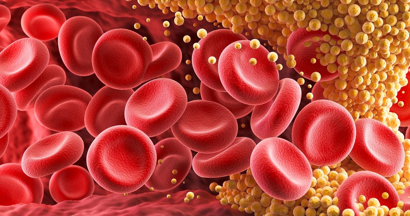 Νέο χάπι μειώνει τα επίπεδα χοληστερόλης κατά 60% – Τι έδειξαν οι πρώτες δοκιμές