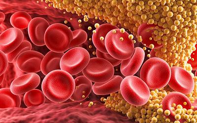 Τέλος στη χοληστερόλη; Το επαναστατικό χάπι που υπόσχεται μείωση έως και 60%