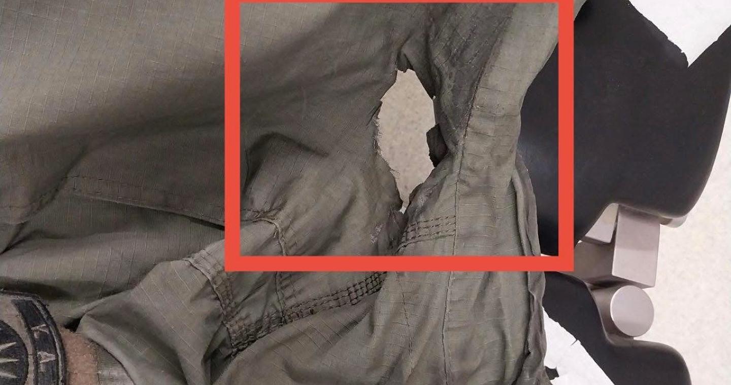 «Δολοφονική επίθεση»: Η στολή του αστυνομικού που τραυματίστηκε από τη βόμβα μολότοφ στο ΑΠΘ