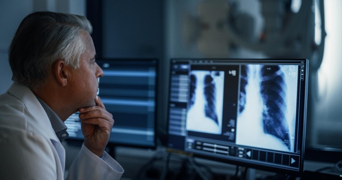 Ο καρκίνος του πνεύμονα αυξάνεται σε μη καπνιστές – Και οι επιστήμονες ψάχνουν τις αιτίες