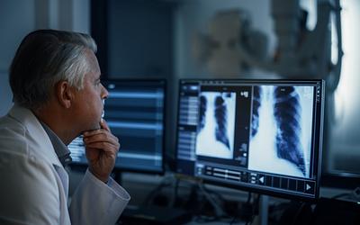 Καρκίνος του πνεύμονα: Γιατί οι μη καπνιστές κινδυνεύουν πλέον περισσότερο από ποτέ