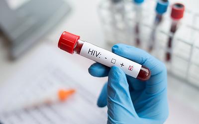 Ελπίδα για την πρόληψη του HIV: Νέο φάρμακο κυκλοφορεί στην Ευρώπη!