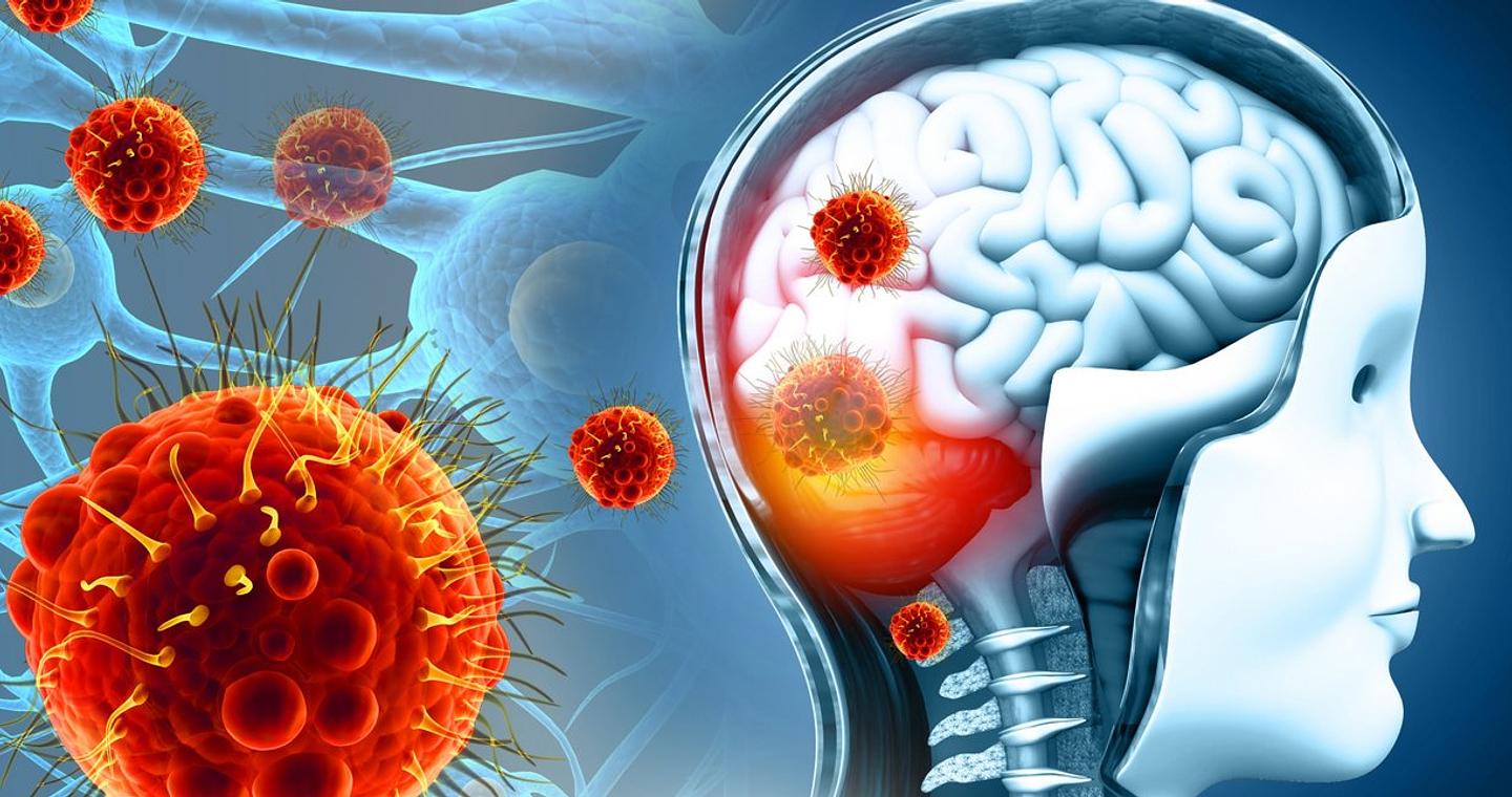 Βρετανία: Δύο νεκροί μετά από ξέσπασμα επιδημίας μηνιγγίτιδας στο Κεντ -Έντεκα σε σοβαρή κατάσταση