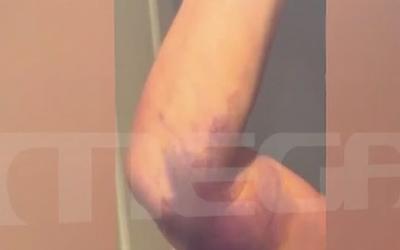 Αποκαλύπτεται το χρονικό της τραγωδίας: Τα μοιραία λάθη που «έκαψαν» τον Μαζωνάκη
